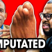Why Deion Sanders Chose to Amputate Two Toes: The Full Story