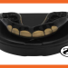 UFC mouthguard: protect your teeth in the octagon.