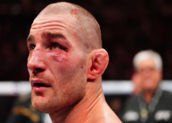 Paulo Costa Hair Transplant: Did He Really Get One?