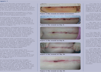BG3 Rotting Wound Cure? Simple Steps to Heal Quickly!