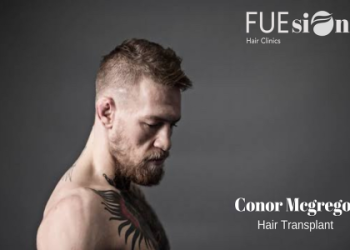 Are those expensive Conor McGregor glasses affordable? Explore the different price points available now!